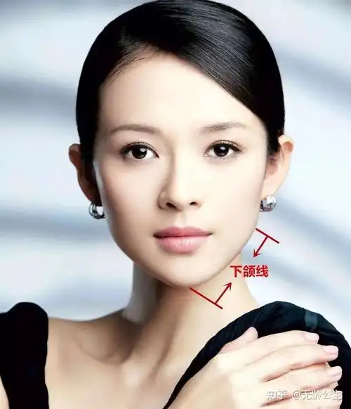 警惕「玻尿酸深层注射下巴」的后遗症 - 知乎